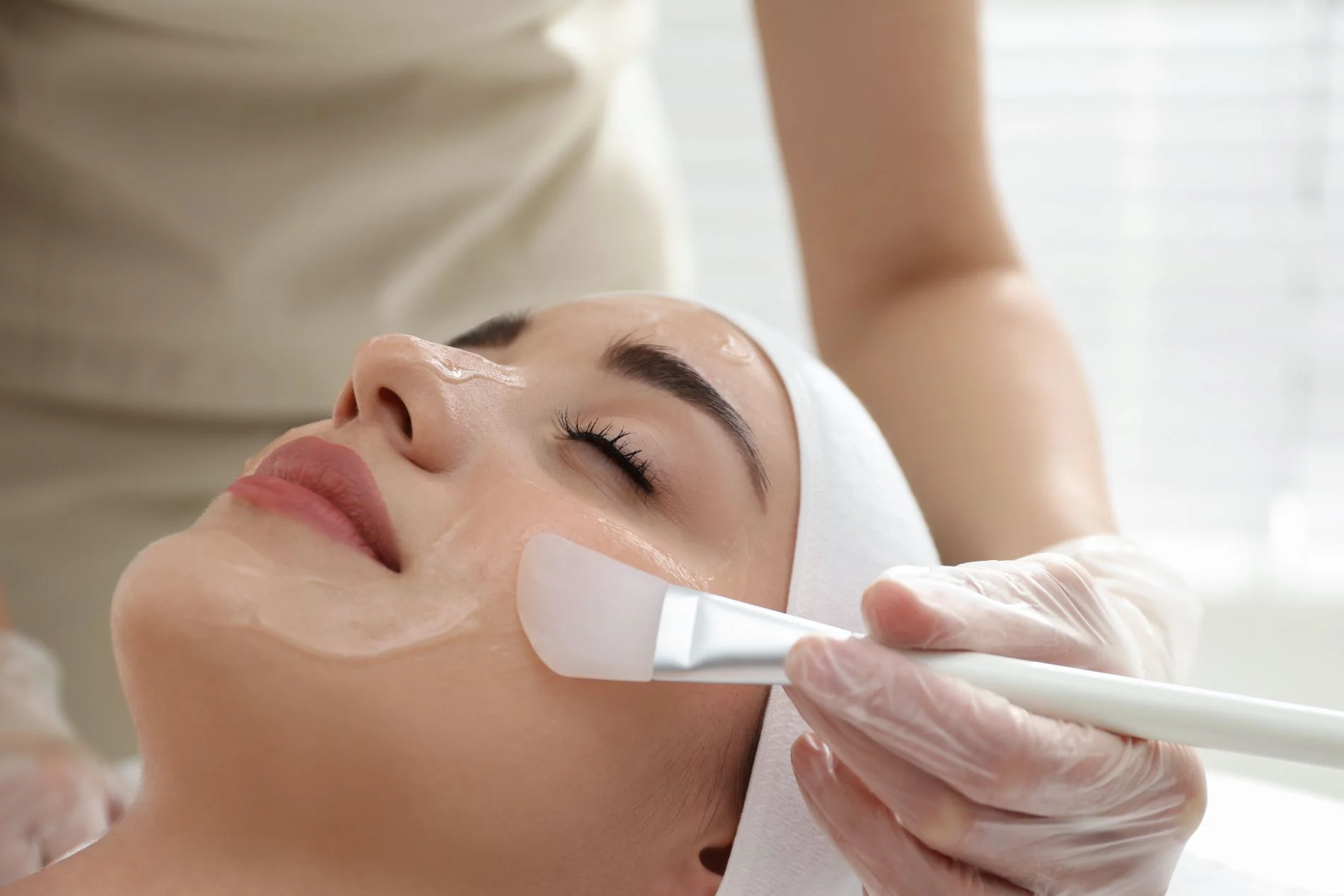 Chemical Peels by MAUDE Medical Aesthetics in Burlington, ON