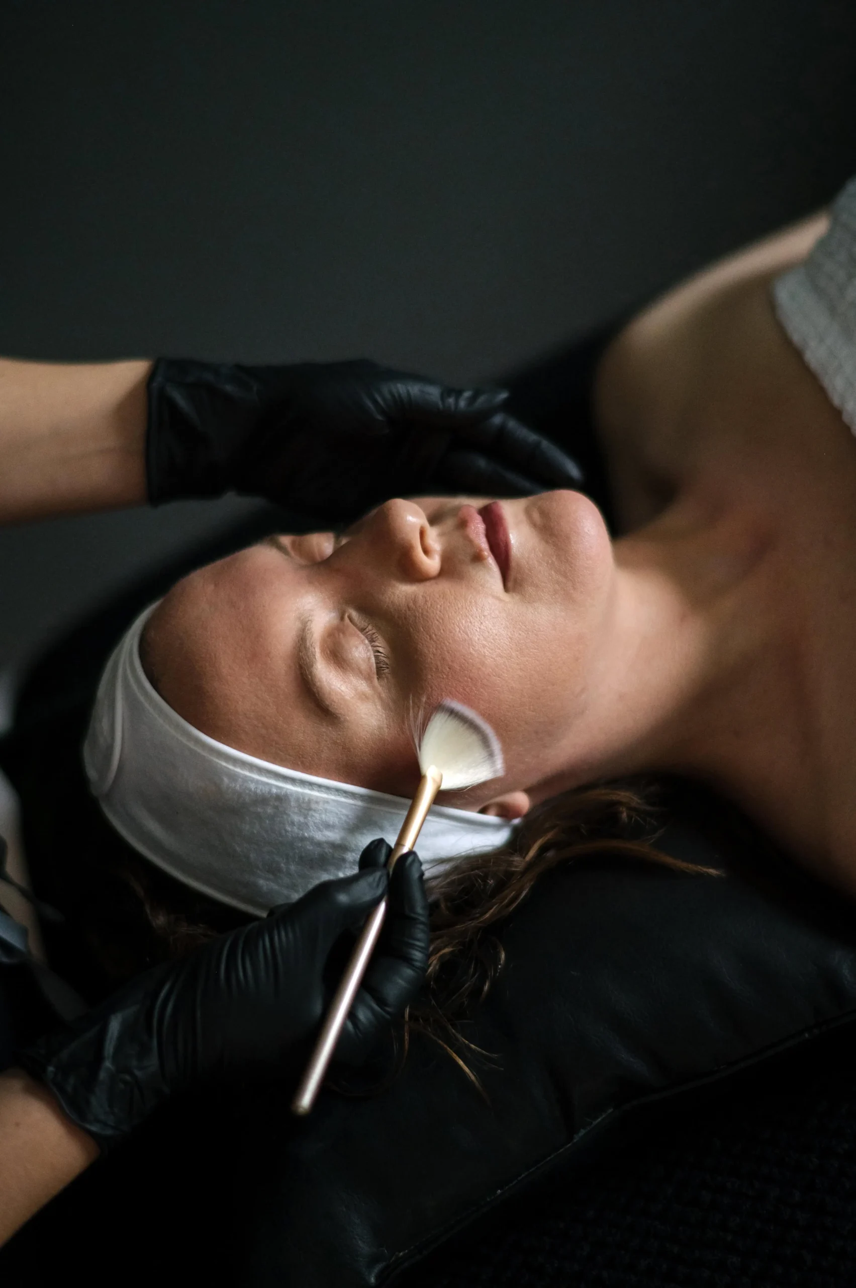CHEMICAL PEEL | MAUDE Medical Aesthetics | Burlington, ON